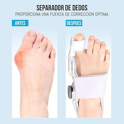 Juanete Corrector Ortopedico Ajustable